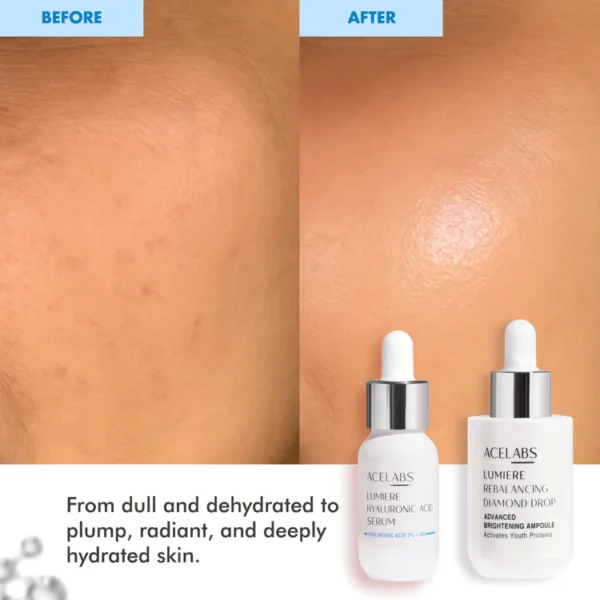 intense hydration duo