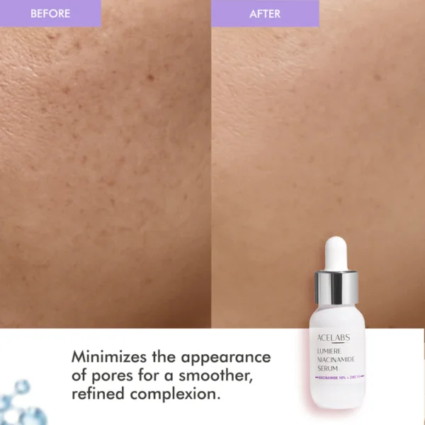 lumiere 10% niacinamide face serum – for pigmentation & acne prone skin 4.6 rating