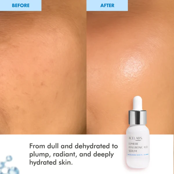 lumiere 2% hyaluronic acid face serum – deep hydration for plump, dewy skin