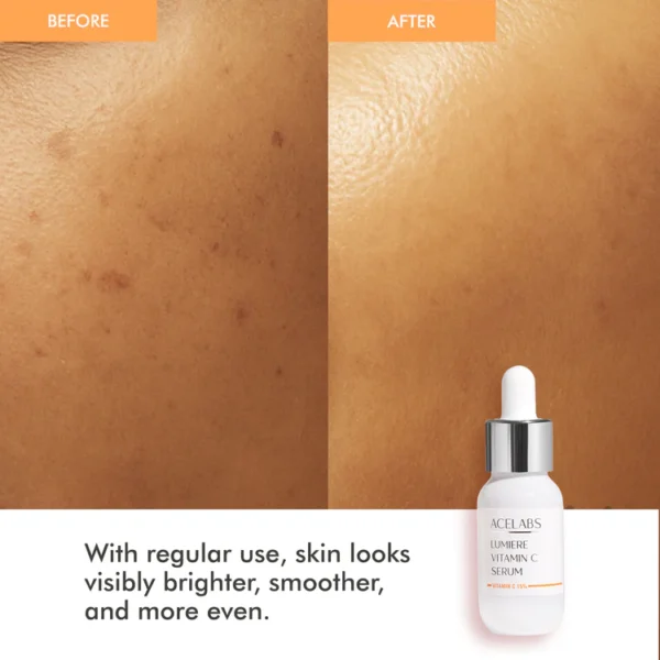 lumiere 15% vitamin c face serum – fades dark spots & boosts glowing skin